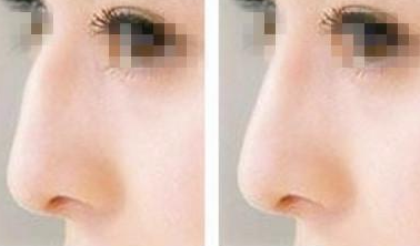 �����շ������ǰ��Ա�