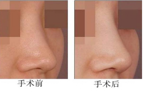 �շ�����η�ʽ