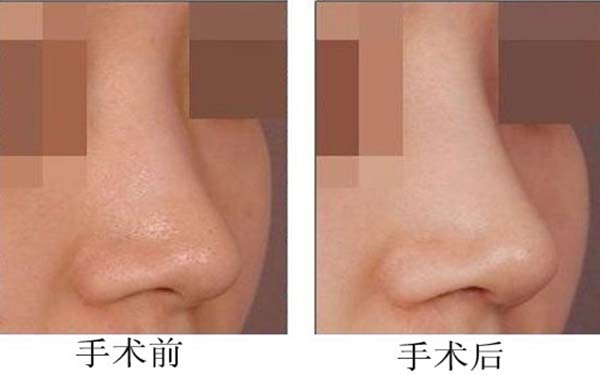 �շ�ǽ���������͹��