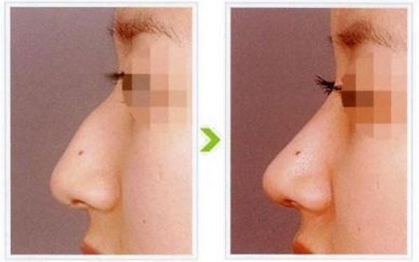 ȫ������շ�ǽ�����