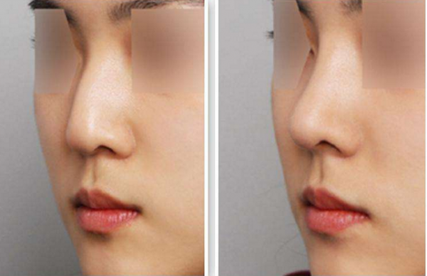 �շ�ǽ����ķ�ʽ���ָ�ʱ��