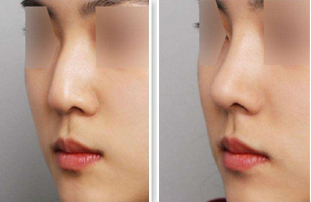 �շ�ǽ����ķ�ʽ���ָ�ʱ��