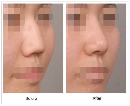 �շ�ǽ������ע������