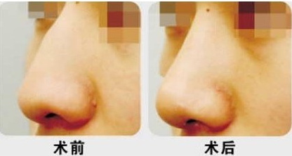 �շ�ǽ�������������Ⱥ