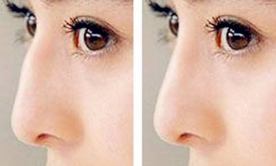 �շ�ǽ����Ĳ��輰������