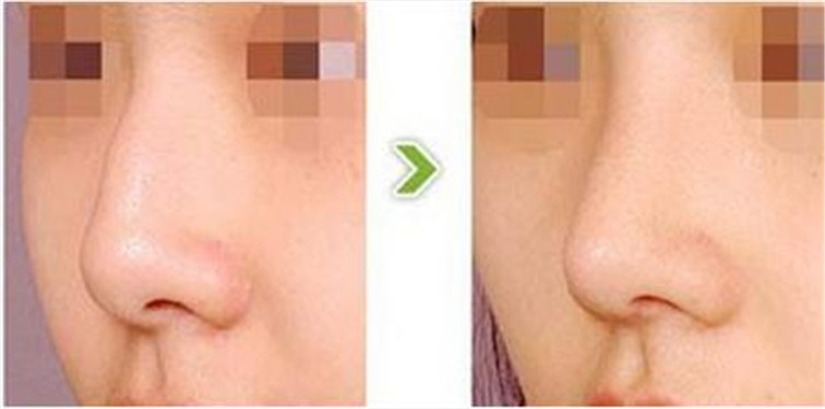 ĥ�շ���з�����?