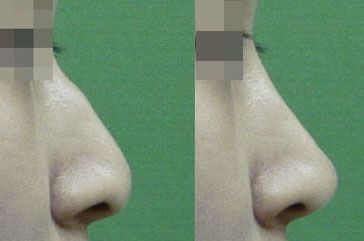 �շ�ǽ����ķ�ʽ���ʺ���Ⱥ