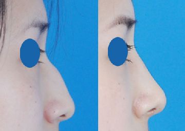 �շ�ǽ����ķ��ռ�����֢