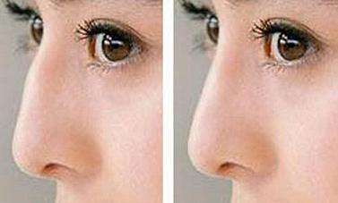 �շ�ǽ����ķ�ʽ������Σ��