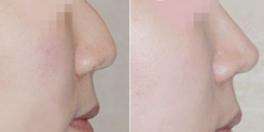 �շ�ǽ����ķ�ʽ��������