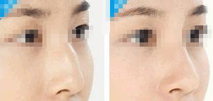 �շ����ǰ����ע������