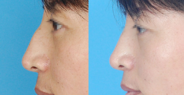 �շ�����ε������пڼ�����