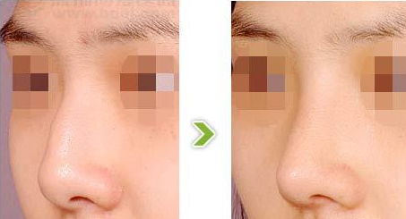 �շ�ǽ�����ǰ����ע������