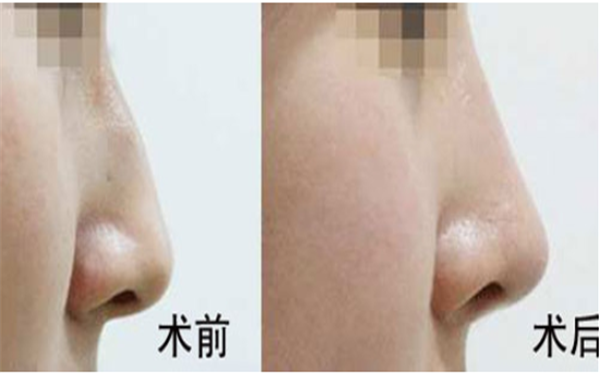 �շ�ǽعǵ���������