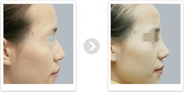 �����շ������ǰ��Ա���