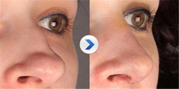 �շ�Ǿ���С����