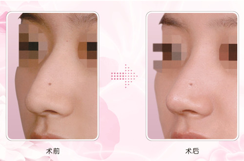 �����շ����ʲô����