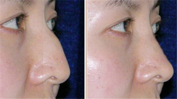 �շ�ǽ���������Ǯ��