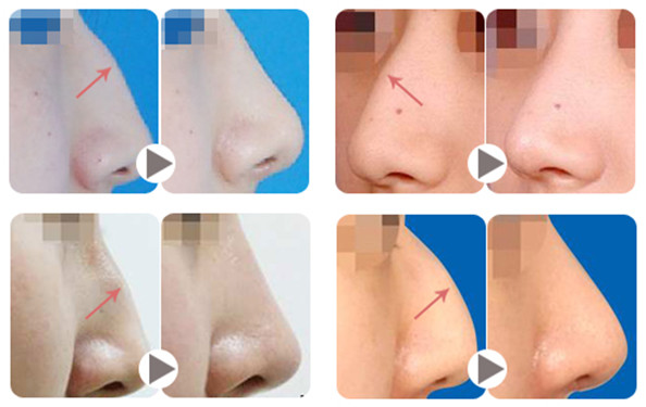 �շ�ǽ�����������ף�