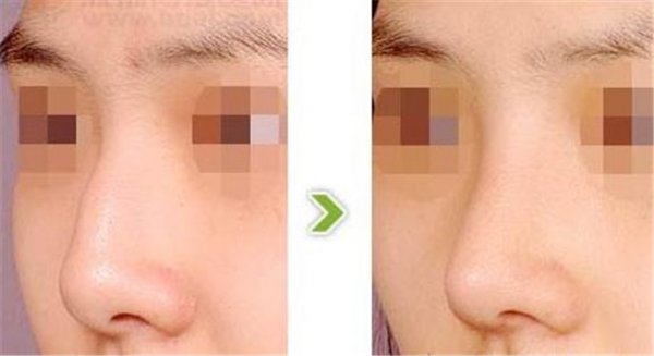 �շ�Ǿ�������Ǯ����