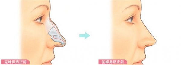 ����շ�ǽ�������Ǯ