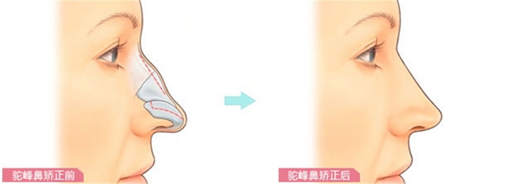 ����շ�ǽ�������Ǯ