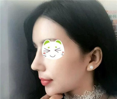 �շ�ǽ�������Ч��ǰ��Ա�