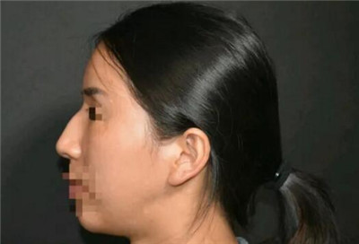 �շ�ǽ�������Ч��ǰ��Ա�