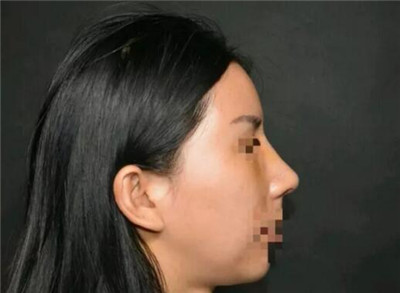 �շ�ǽ�������Ч��ǰ��Ա�