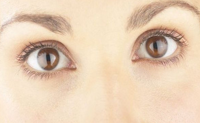 眼部修复多久恢复自然