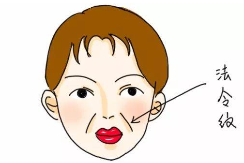 鼻基底凹陷和法令纹的区别 鼻基底凹陷和法令纹的区别