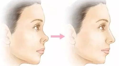 ��ǻ��׶Ա�ͼƬ