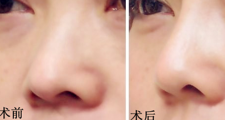 ��ǻ���ǰ��Ա�