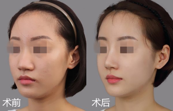 �ǻ������ε�ע������