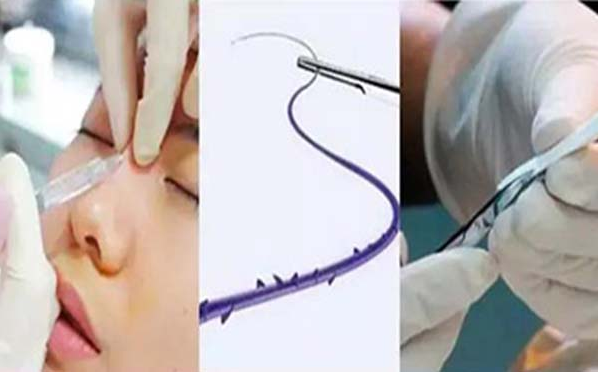 �������ǻ�������������ʲô����