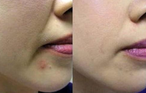 �Ǵ����������Ǯ