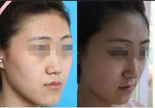 ��������ǻ����ܱ��ֶ��