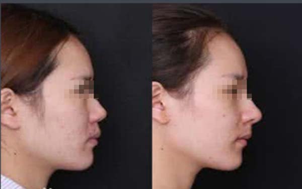 ���ӵ�ɽ������Ǯ