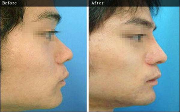 ���������ǻ��׼۸�