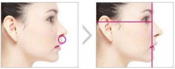 ��ǻ��׷�������Щ