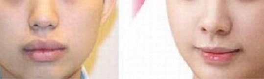 ������С����ǰ��