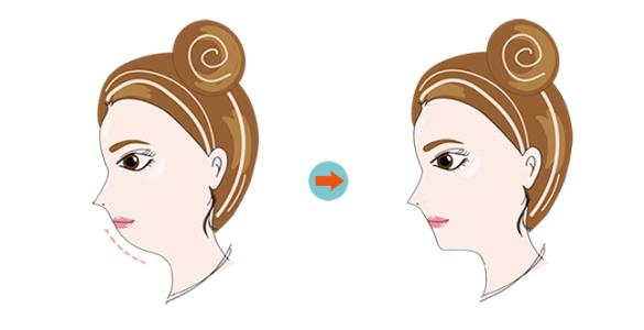 ��������η���