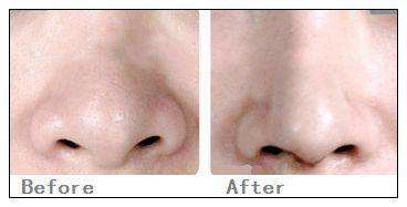 ��ͷ���ݵĻ�������