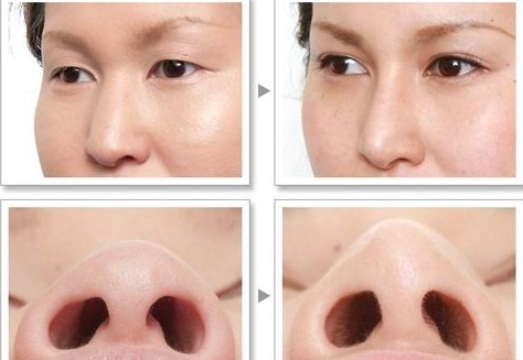 ��ͷ��С��Ȼ��