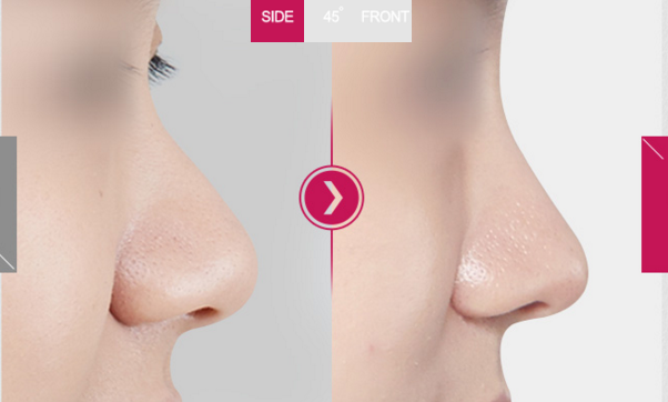 ��ͷ��С�ָ��Ա�ͼ