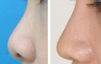 ��ͷ��С������ô������