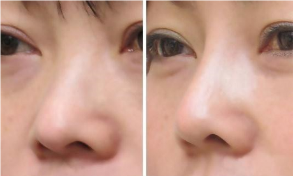 ��ͷ�ʴ����������ĸ�������ʲô�أ�