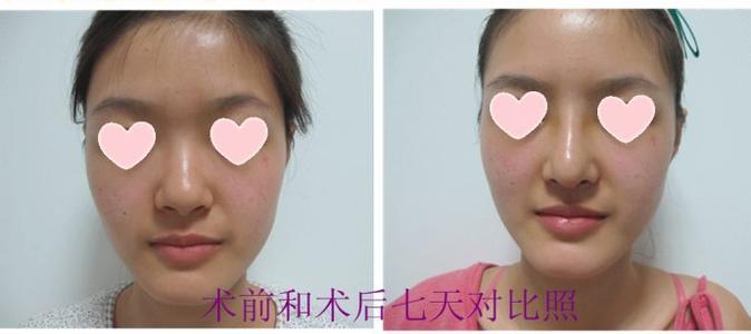 ����ͷ��С����ʱҪע�������