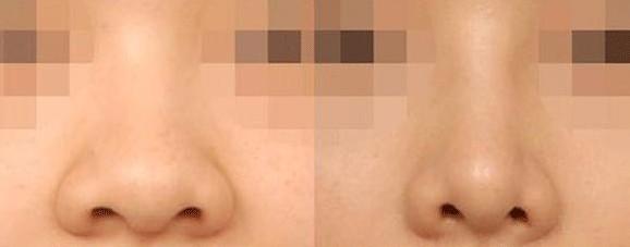 ������С������ָ���Ҫ���