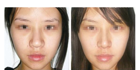 �Ǽ���С���ĺô�